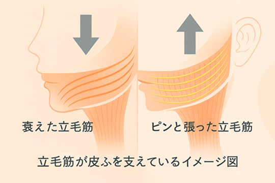 立毛筋の衰えた状態とピンと張った状態を比較したイラスト。左は筋肉が緩み皮膚がたるんでいる様子、右は筋肉が整列し皮膚を支えている様子を示している。